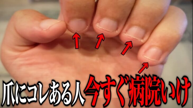 【衝撃】自分では絶対に気づけない体の危険信号がヤバすぎた…知らないと損する日常で使える雑学がツッコミどころ満載だったwwwwww傑作選#10【都市伝説】【なろ屋】【ツッコミ】